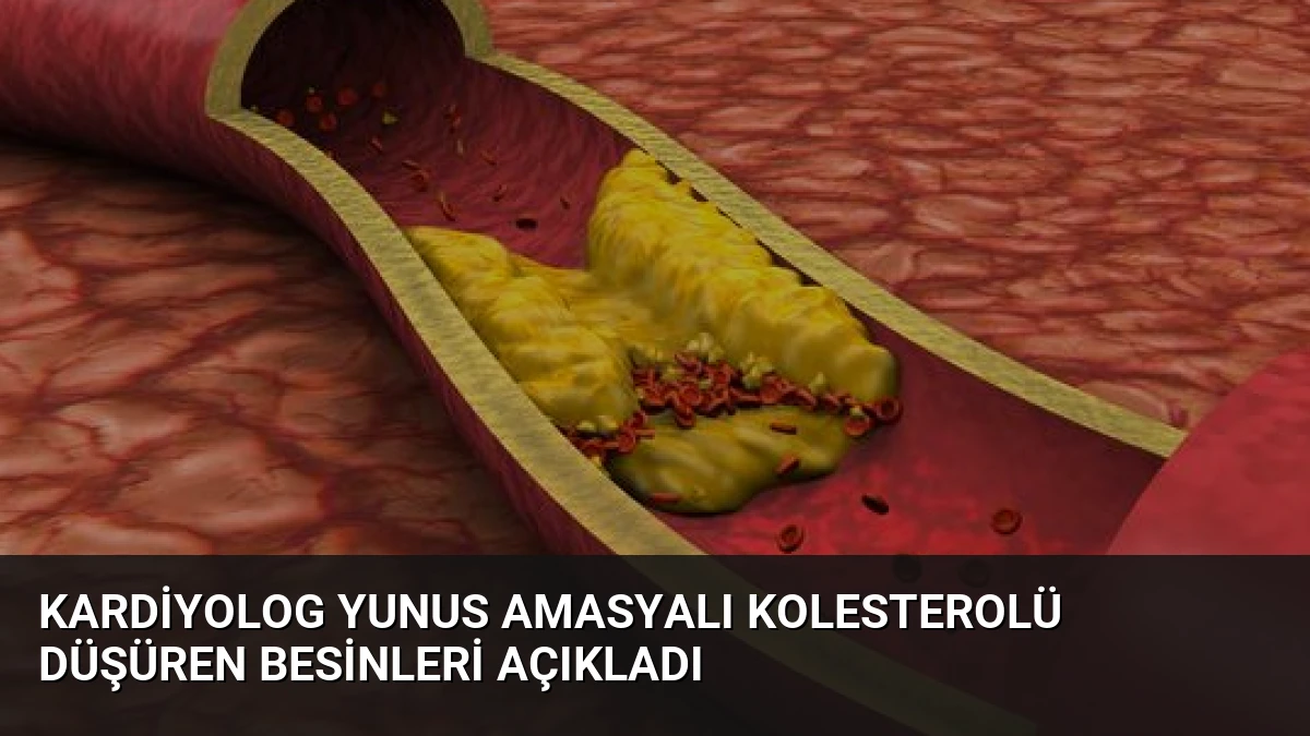 Kardiyolog Yunus Amasyalı Kolesterolü Düşüren Besinleri Açıkladı