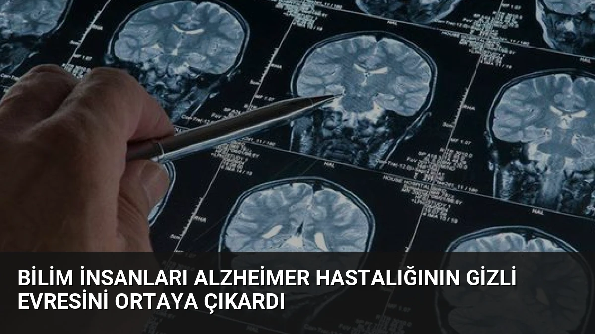 Bilim İnsanları Alzheimer Hastalığının Gizli Evresini Ortaya Çıkardı