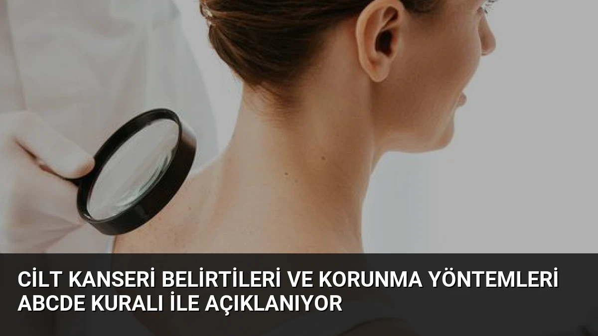 Cilt Kanseri Belirtileri ve Korunma Yöntemleri ABCDE Kuralı ile Açıklanıyor