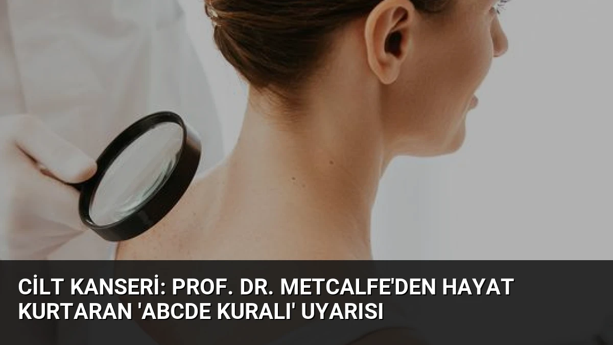 Cilt Kanseri: Prof. Dr. Metcalfe’den Hayat Kurtaran ‘ABCDE Kuralı’ Uyarısı