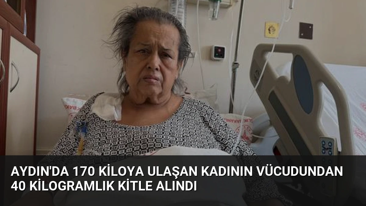 Aydın’da 170 Kiloya Ulaşan Kadının Vücudundan 40 Kilogramlık Kitle Alındı