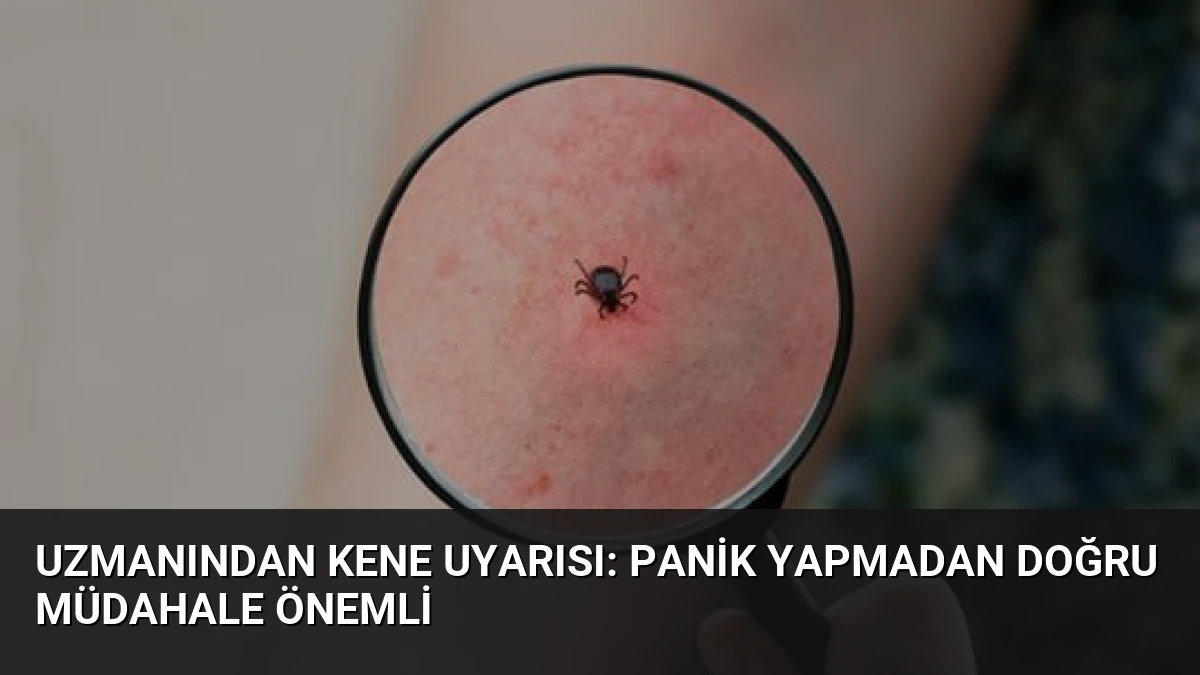 Uzmanından Kene Uyarısı: Panik Yapmadan Doğru Müdahale Önemli