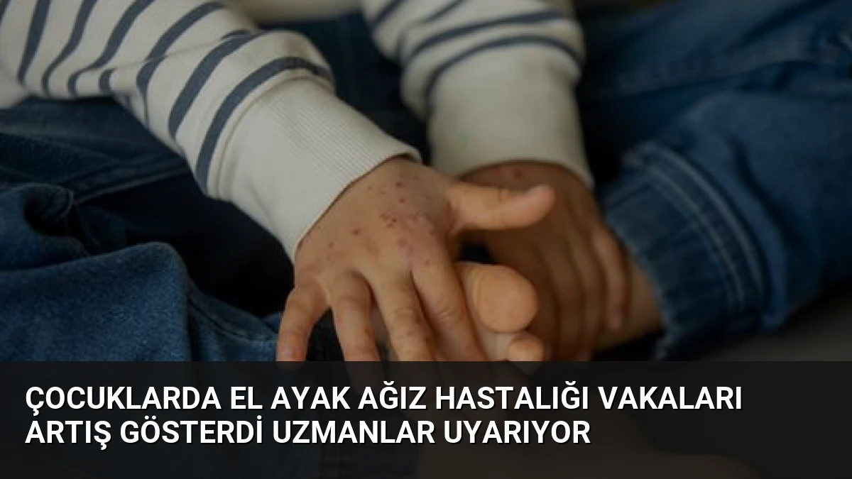 Çocuklarda El Ayak Ağız Hastalığı Vakaları Artış Gösterdi Uzmanlar Uyarıyor