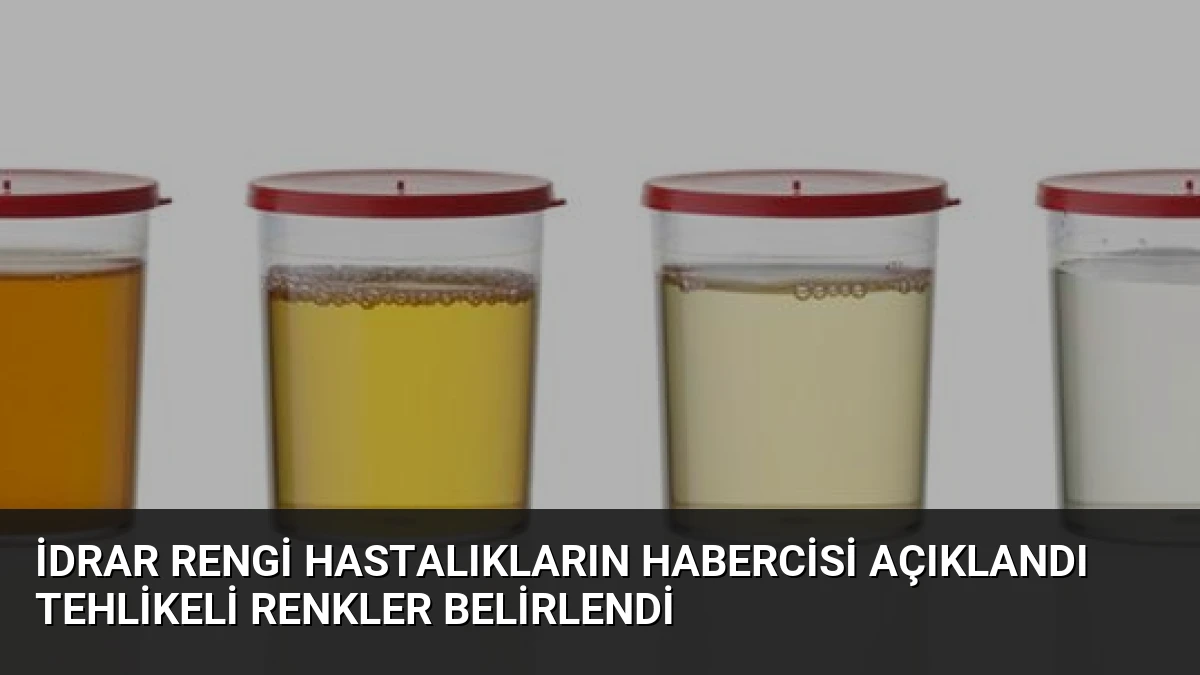 İdrar Rengi Hastalıkların Habercisi Açıklandı Tehlikeli Renkler Belirlendi